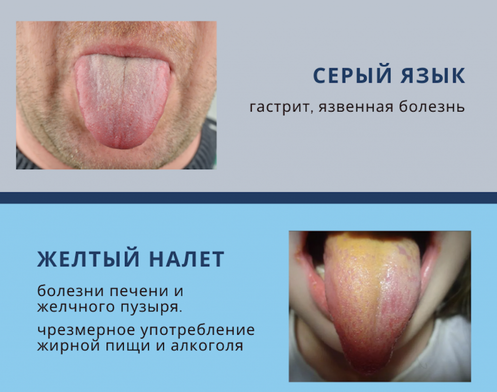 Снимок экрана 2021-04-03 в 15.23.56.png