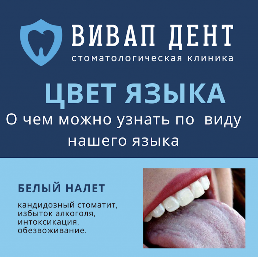 Снимок экрана 2021-04-03 в 15.23.49.png