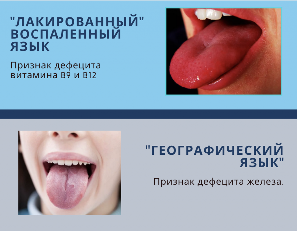 лакированный язык