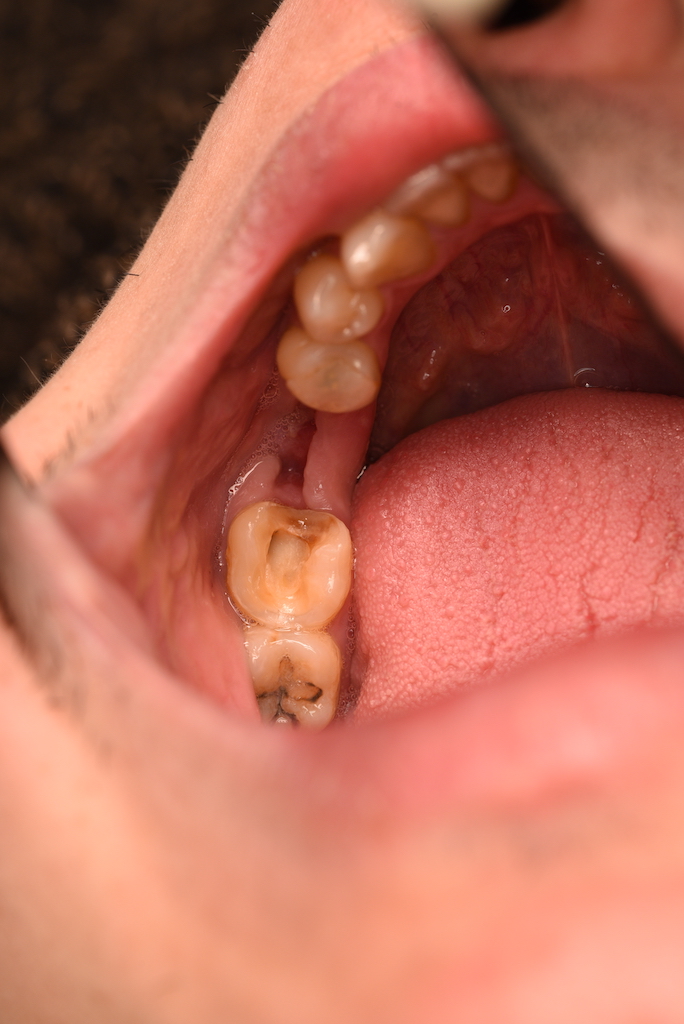 DSC_3175.JPG