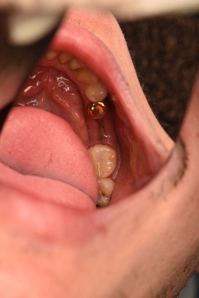 DSC_3170.JPG